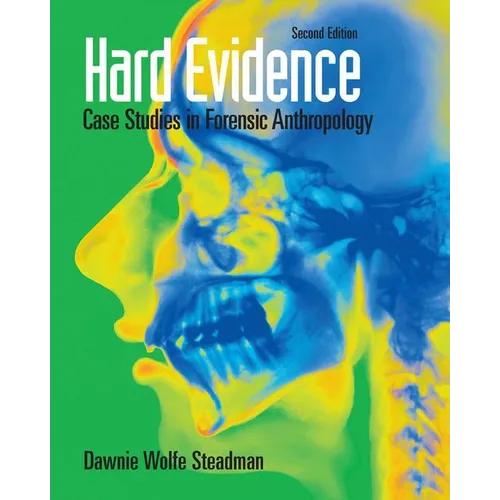 Hard Evidence: Case Studies in Forensic Anthropology - Paperback