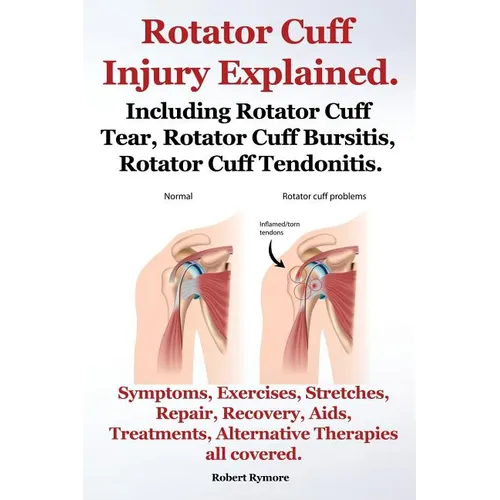 Rotator Cuff Injury Explained. Including Rotator Cuff Tear, Rotator Cuff Bursitis, Rotator Cuff Tendonitis. Symptoms, Exercises, Stretches, Repair, Re - Paperback