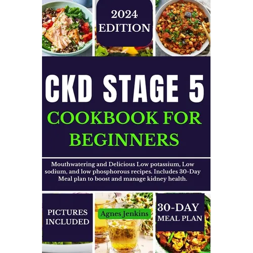 Ckd Stage 5 Cookbook for Beginners: Mouthwatering and Delicious Low potassium, Low sodium, and low phosphorus recipes. Includes a 30-Day Meal plan to - Paperback