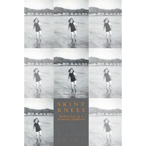 Skint Knees: Reflections on a Scottish Childhood - Paperback