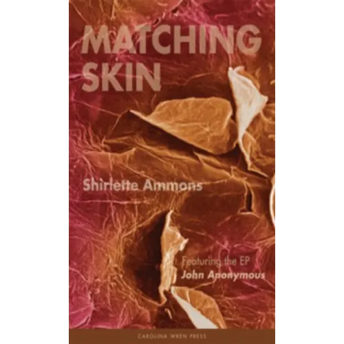 Matching Skin - Paperback