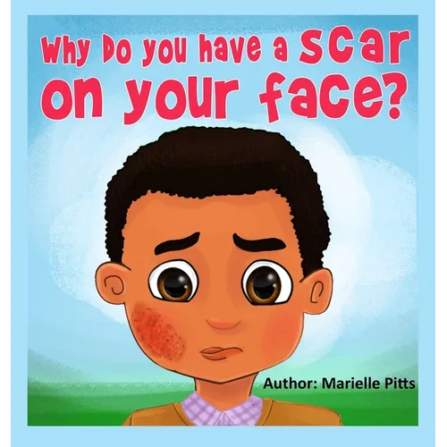 Why do you have a scar on your face? - Hardcover