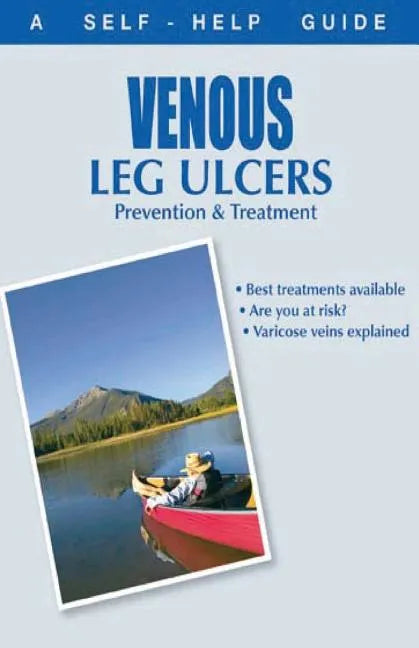 The Doctor's Guide to: Venous Leg Ulcers: Prevention and Treatment - Paperback