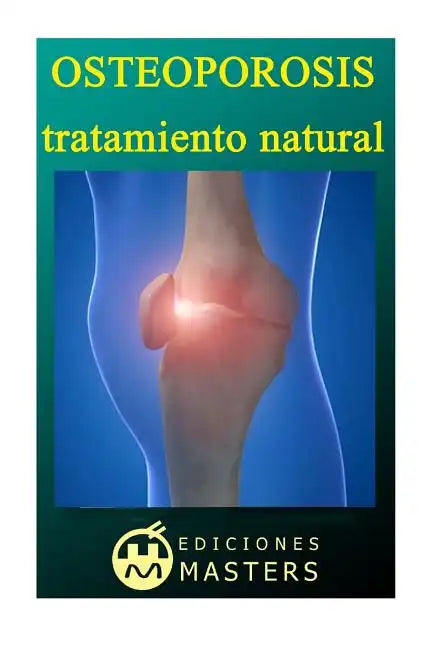 Osteoporosis: Tratamiento natural - Paperback