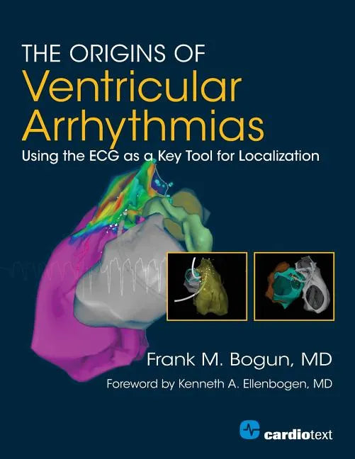 The Origins of Ventricular Arrhythmias: Using the ECG as a Key Tool for Localization - Paperback