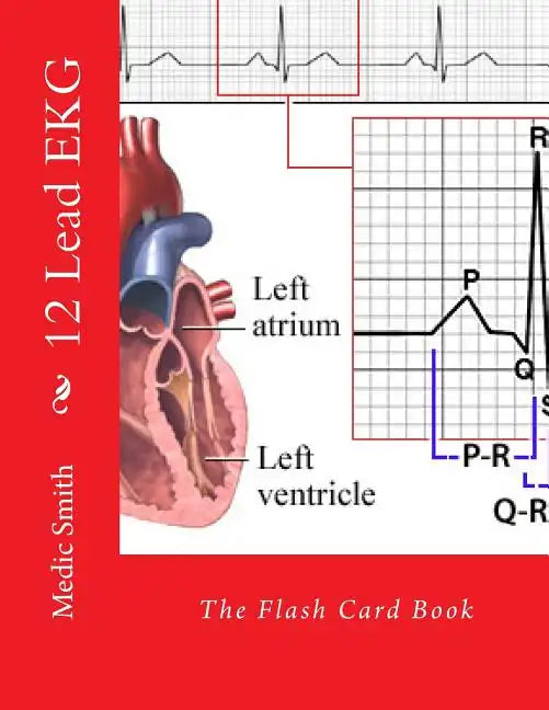12 Lead EKG: The Flash Card Book - Paperback