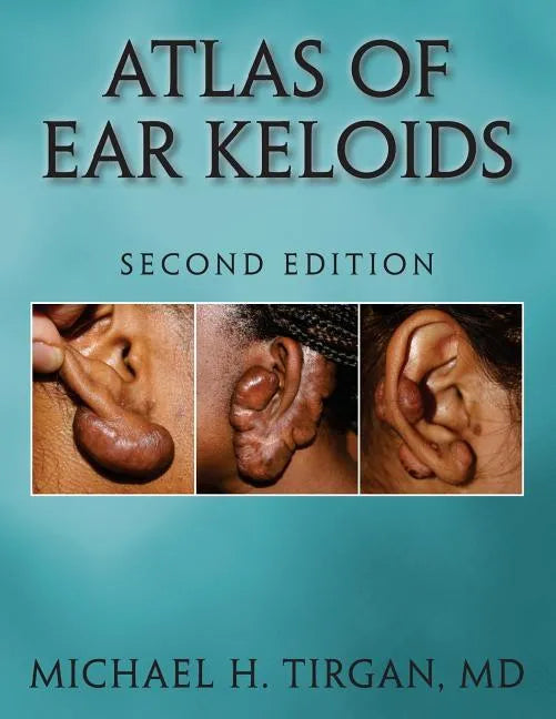 Atlas of Ear Keloids - Second Edition - Paperback