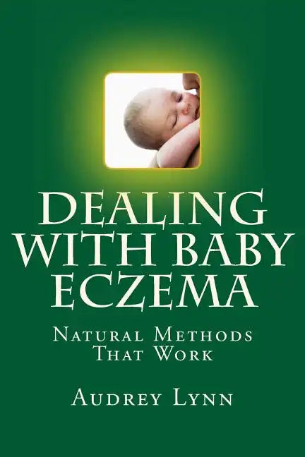 Dealing With Baby Eczema: Natural Methods That Work - Paperback
