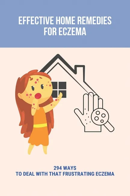 Effective Home Remedies For Eczema: 294 Ways To Deal With That Frustrating Eczema: Homeopathic Remedies For Eczema - Paperback