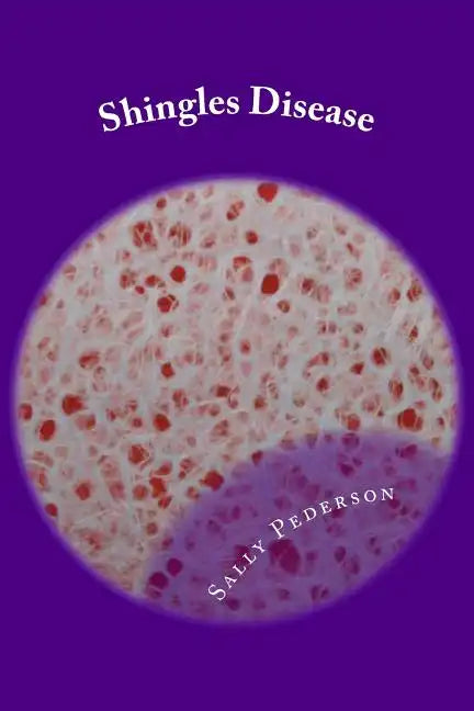 Shingles Disease: The Complete Guide - Paperback