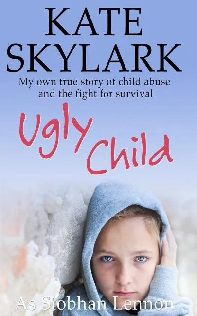 Ugly Child: My Own True Story of Child Abuse and the Fight for Survival - Paperback