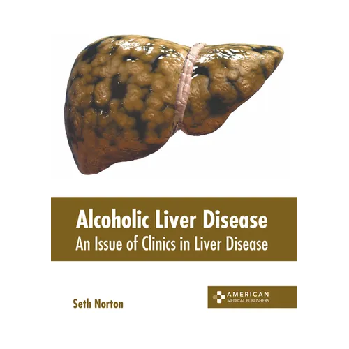 Alcoholic Liver Disease: An Issue of Clinics in Liver Disease - Hardcover