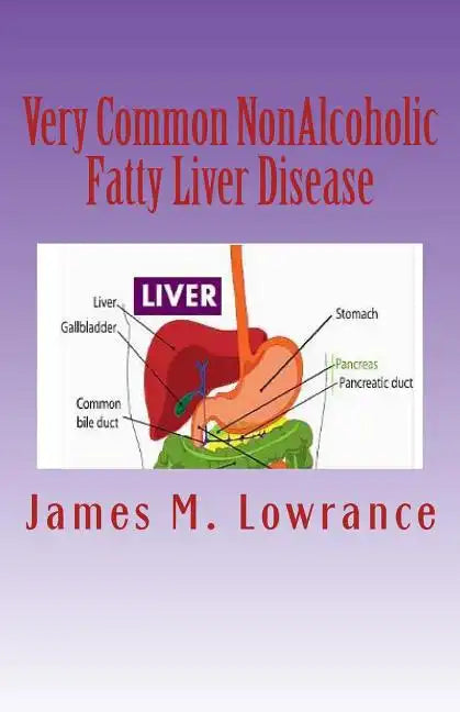 Very Common NonAlcoholic Fatty Liver Disease: How To Know if You Have Hepatic Steatosis - Paperback