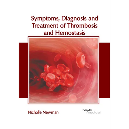 Symptoms, Diagnosis and Treatment of Thrombosis and Hemostasis - Hardcover