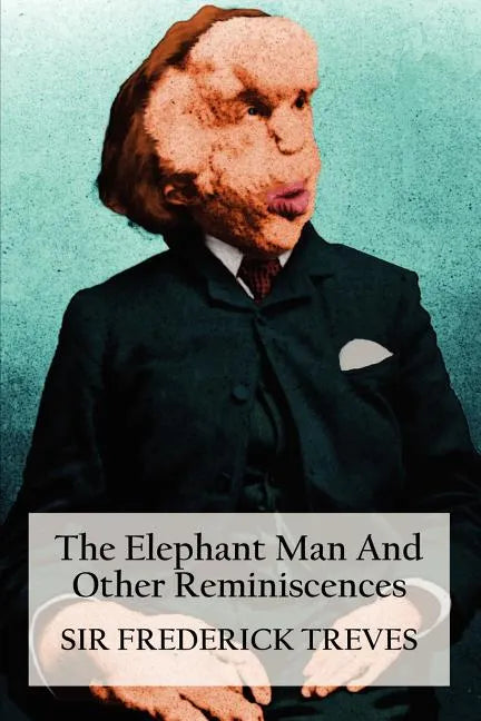 The Elephant Man and Other Reminiscences - Paperback