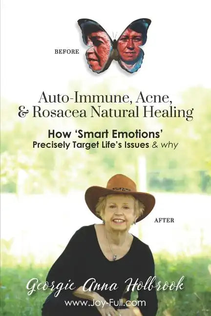 Auto-Immune, Acne, & Rosacea Natural Healing - How 'Smart Emotions' Precisely Target Life's Issues & Why - Paperback