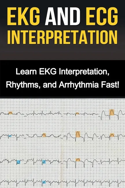 EKG and ECG Interpretation: Learn EKG Interpretation, Rhythms, and Arrhythmia Fast! - Paperback