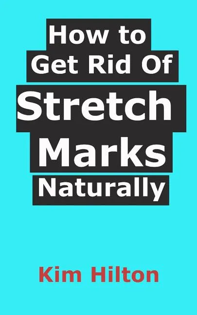 How to Get Rid Of Stretch Marks Naturally - Paperback