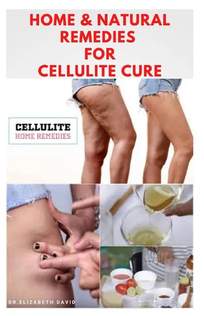Home & Natural Remedies for Cellulite Cure: Practical Guide On The Best Remedies To Get Rid Of Your Cellulite: Everything You Need To Know - Paperback