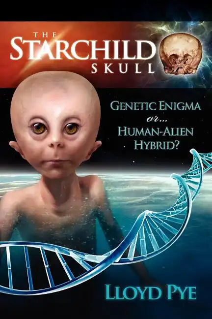 The Starchild Skull -- Genetic Enigma or Human-Alien Hybrid? - Paperback