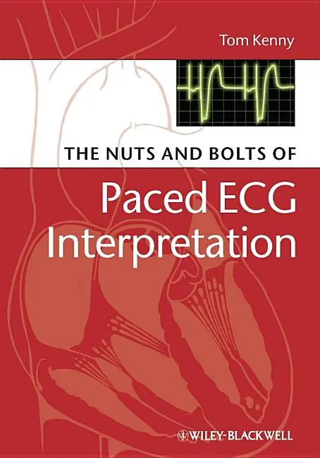 The Nuts and Bolts of Paced ECG Interpretation - Paperback