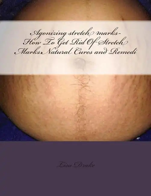 Agonizing stretch marks-How To Get Rid Of Stretch Marks: Natural Cures and Remedi - Paperback