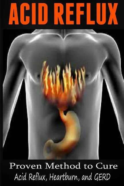 Acid Reflux: Proven Methods to Cure Acid Reflux, Heartburn, and GERD - Paperback