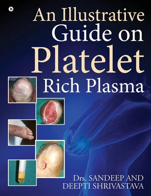 An Illustrative Guide on Platelet Rich Plasma - Paperback