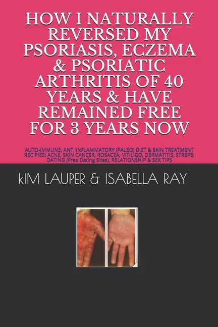 How I Naturally Reversed My Psoriasis, Eczema and Psoriatic Arthritis of 40 Years and Have Remained Free for 3 Years Now: AUTO IMMUNE, GLUTEN FREE, DA - Paperback