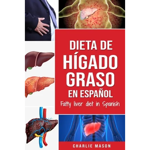Dieta de hígado graso en español/Fatty liver diet in Spanish - Paperback