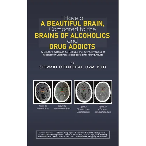 I Have a Beautiful Brain, Compared to the Brains of Alcoholics and Drug Addicts - Paperback