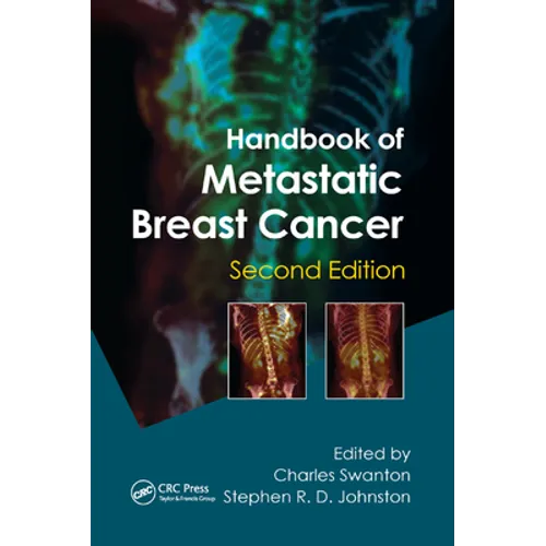 Handbook of Metastatic Breast Cancer - Paperback
