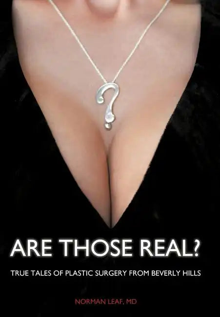 Are Those Real?: True Tales of Plastic Surgery from Beverly Hills - Hardcover