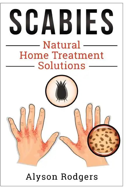 Scabies Natural Home Treatment Solution - Paperback