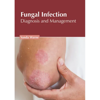 Fungal Infection: Diagnosis and Management - Hardcover