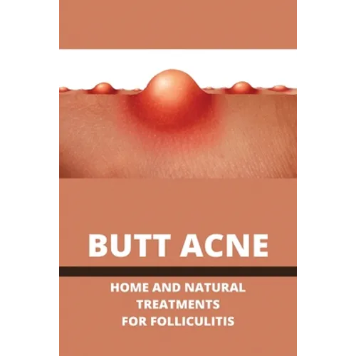 Butt Acne: Home And Natural Treatments For Folliculitis: Barber'S Itch Home Remedies - Paperback