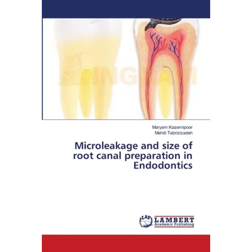 Microleakage and size of root canal preparation in Endodontics - Paperback