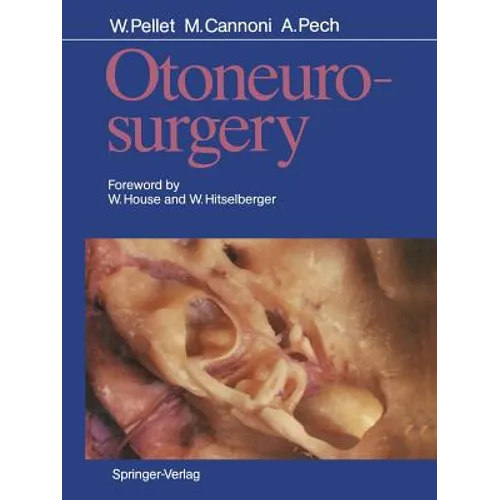 Otoneurosurgery - Paperback