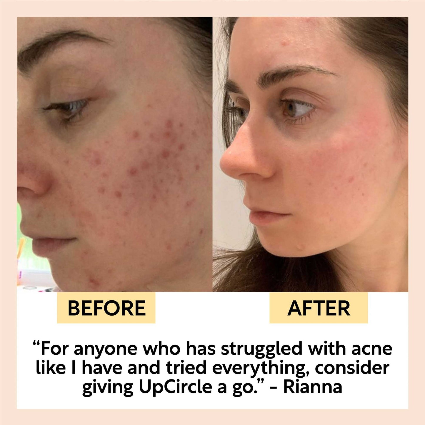 Face Toner with Hyaluronic Acid