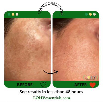 PREMIUM 100% VEGAN Rejuvenating JELLY FACE MASK With Retinol + Turmeric + Aloe Vera + Lactic acid + Rosemary Leaf