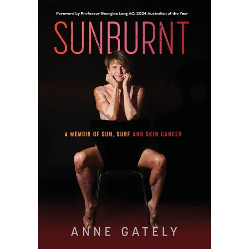 Sunburnt: A memoir of sun, surf and skin cancer - Hardcover