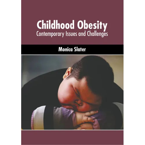Childhood Obesity: Contemporary Issues and Challenges - Hardcover