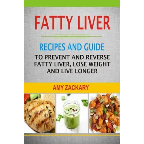 Fatty Liver: Recipes And Guide To Prevent And Reverse Fatty Liver, Lose Weight And Live Longer - Paperback