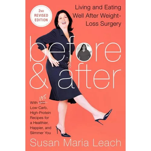 Before & After, Second Revised Edition: Living and Eating Well After Weight-Loss Surgery - Paperback