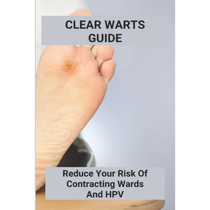 Clear Warts Guide: Reduce Your Risk Of Contracting Wards And Hpv: Does Duct Tape Get Rid Of Warts - Paperback