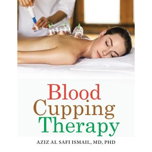 Blood Cupping Therapy - Paperback