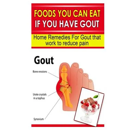 Foods You Can Eat If You Have Gout: Home Remedies for Gout That Work to Reduce Pain - Paperback