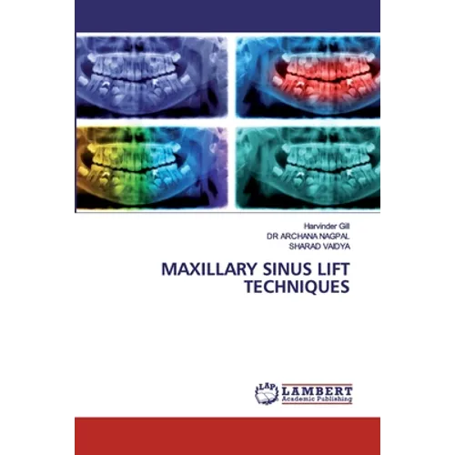 Maxillary Sinus Lift Techniques - Paperback