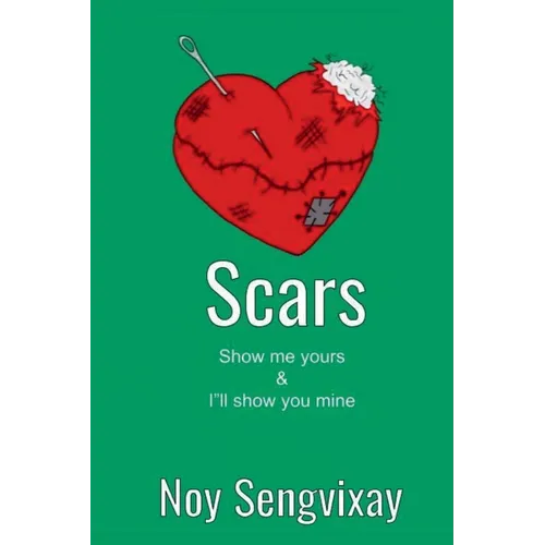 Scars - Paperback