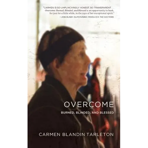 Overcome: Burned, Blinded, and Blessed - Paperback